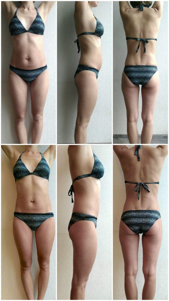 восстановление после родов